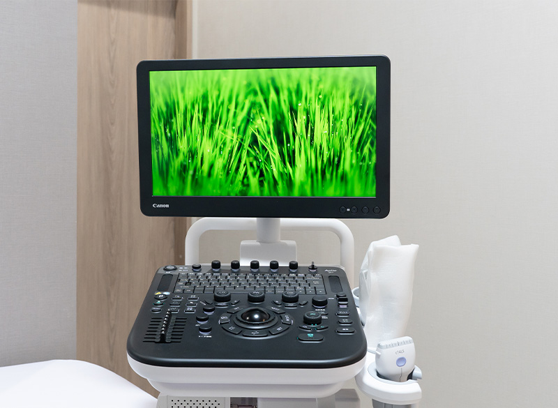 超音波診断装置