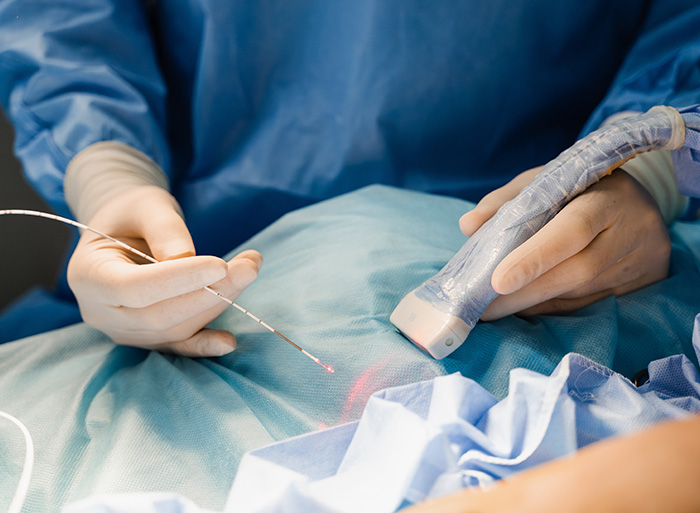 下肢静脈瘤の日帰り手術